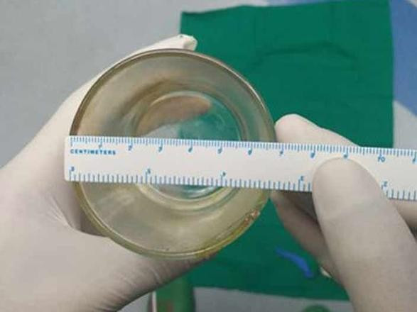 Makatından bardak çıktı akıllara zarar olaya herkes şaştı kaldı - Resim: 3