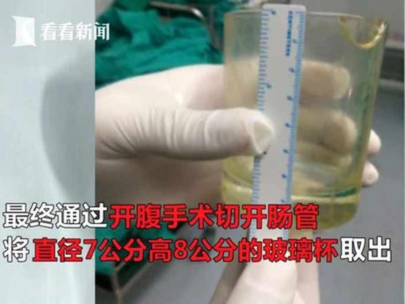 Makatından bardak çıktı akıllara zarar olaya herkes şaştı kaldı - Resim: 4