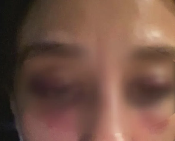 Sevgilisini dövüp kan izlerini silen Rubato’nun solisti Özer Arkun için istenen hapis cezası belli oldu - Resim: 4