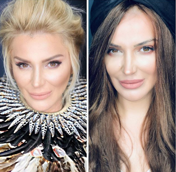 Songül Karlı'nın son hali şaşırttı bir anda bambaşka birine dönüştü - Resim: 2