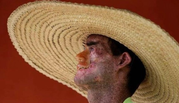 Bu köydeki herkes güneş görünce eriyor! - Resim: 4