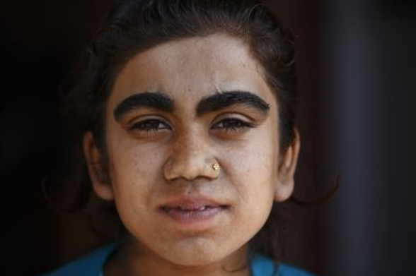 Onlar sizin bildiklerinizden çok farklı tüm aile bu halde - Resim: 4