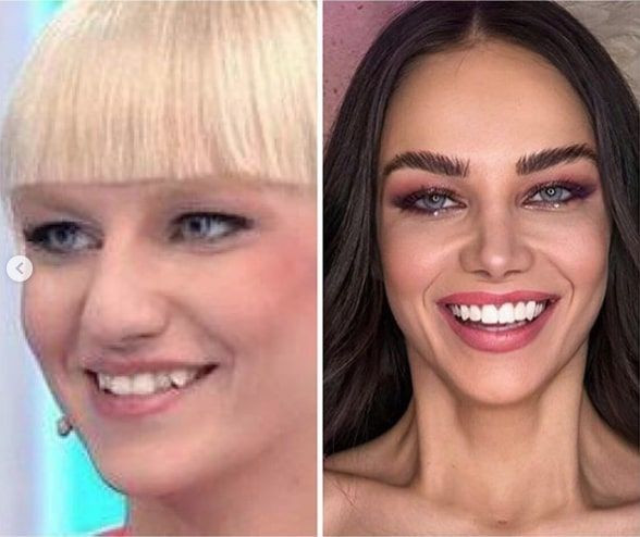 Bu Tarz Benim Ayşenur Balcı'nın eski hali ortaya çıktı estetikle bu kadar değişmiş - Resim: 3