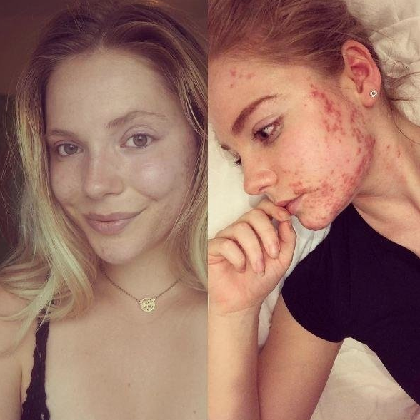 Hayatı kabusa dönmüştü! Keşfettiği besinle yeniden doğdu - Resim: 1