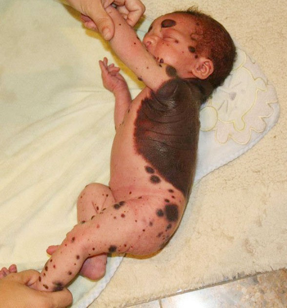 Bebek bu halde doğdu anne baba şoke oldu gerçekler ortaya çıkınca... - Resim: 1