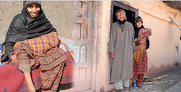 Yüzü olmayan adamın mucize bebeği - Resim: 2