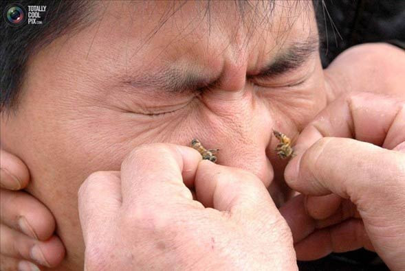 Her şey şifa için - Resim: 4