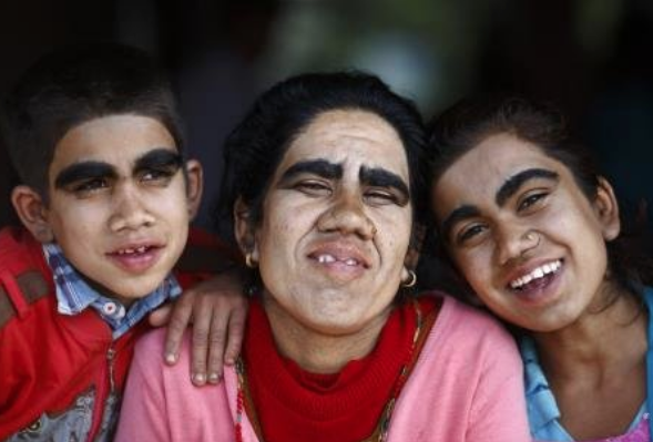 Onlar sizin bildiklerinizden çok farklı tüm aile bu halde - Resim: 1