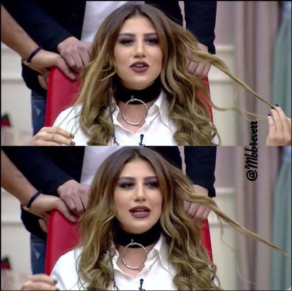 Kısmetse Olur Melis estetik oldu instagram'da olay fotoğraf - Resim: 4