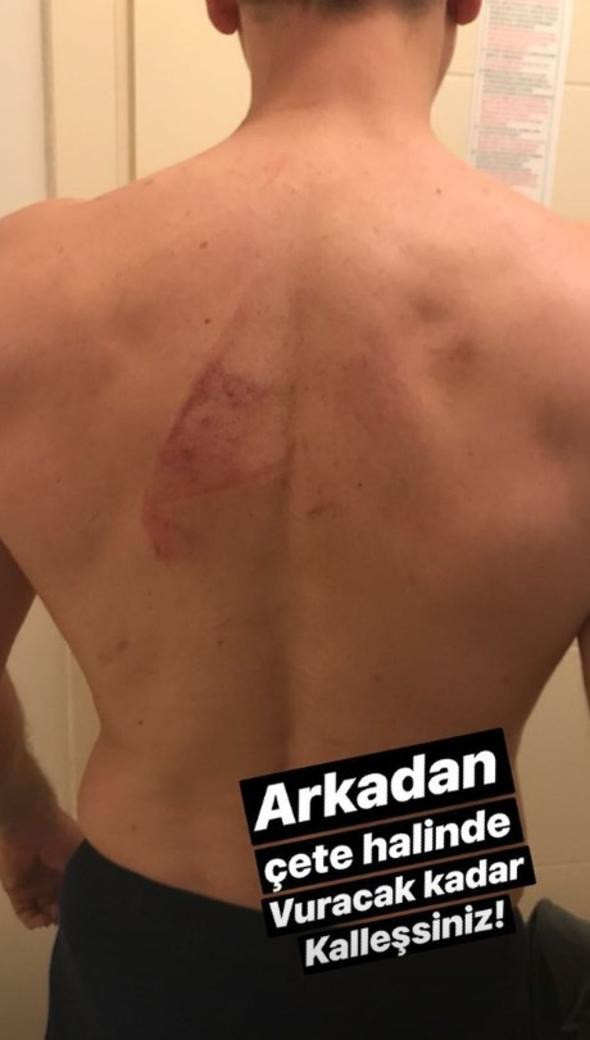 15 kişi üstüne çullanmış! Emre Aşık isyan bayrağını çekti - Resim: 4