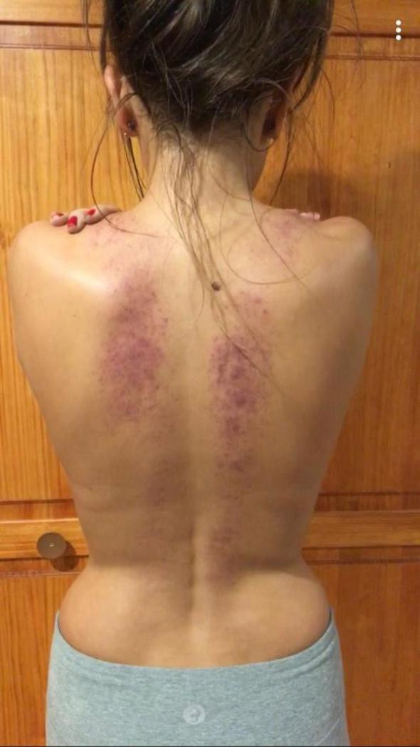 'İlgi çekmeye çalışıyorsun' dediler acı gerçeği öğrendi dünyası başına yıkıldı - Resim: 3