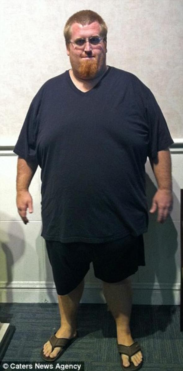 'Yaşayamaz ölürsün' demişlerdi kilo verdi bambaşka biri oldu - Resim: 2