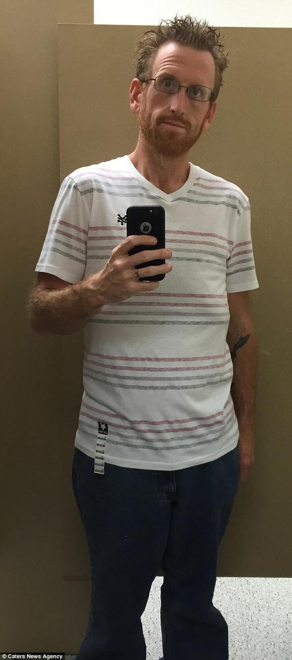 'Yaşayamaz ölürsün' demişlerdi kilo verdi bambaşka biri oldu - Resim: 4