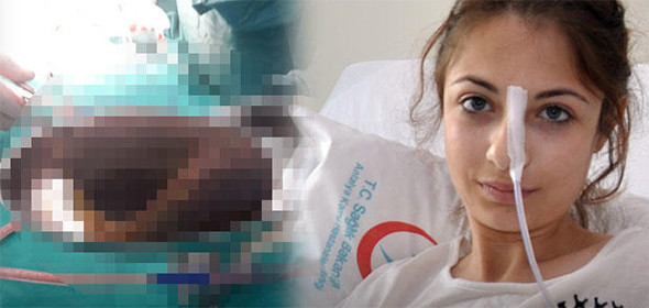 Karın ağrısıyla gitti: Hasta da doktor da gözlerine inanamadı! - Resim: 1