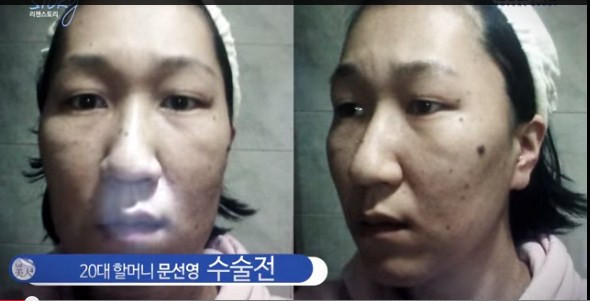 Koreli kadının estetik mucizesi - Resim: 2