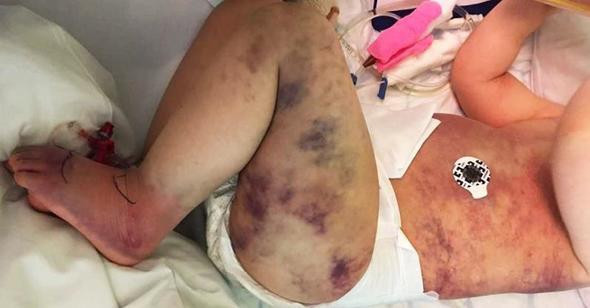 Oğlunu arı soktu sanmıştı! Gerçeği öğrenince hayatının şokunu yaşadı - Resim: 2