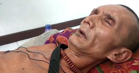 Hayatı bir gecede karardı! Vücudu taşlaşıyor resmen  - Resim: 2