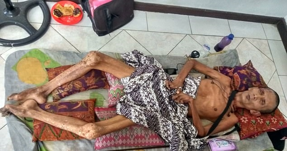 Hayatı bir gecede karardı! Vücudu taşlaşıyor resmen  - Resim: 3