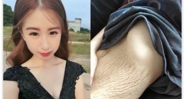 Doğum izlerini paylaştı kimse inanamadı - Resim: 1