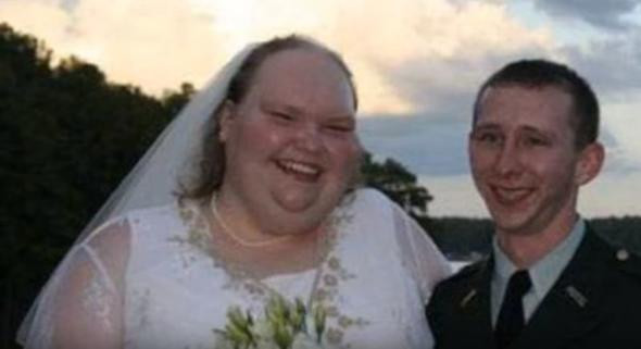 'Dünyanın en çirkin geliniydi' son hali şaşırttı - Resim: 2