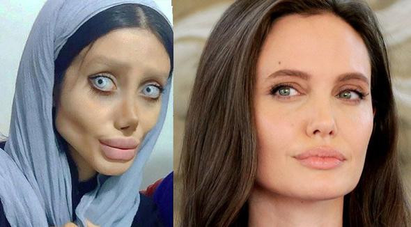 Angelina Jolie’ye benzemek istedi! Sonuç korkunç - Resim: 1