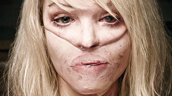 Hem tecavüze uğradı hem de bu hale getirildi şimdi de... - Resim: 1