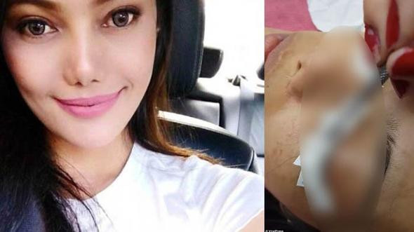 Güzellik uğruna kirpiklerinden oldu - Resim: 4