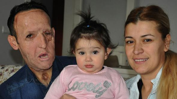 Yüz nakilli Recep Sert tutuklandı! - Resim: 4