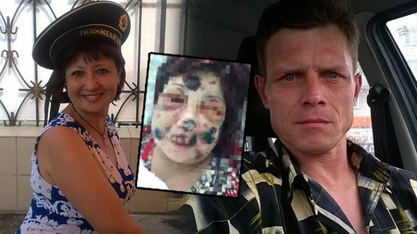 Genç kadını bu hale getirdi serbest bırakıldı! - Resim: 1