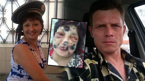 İnternetten tanıştığı kadına yaptıkları kan dondurdu! Isırıp... - Resim: 1