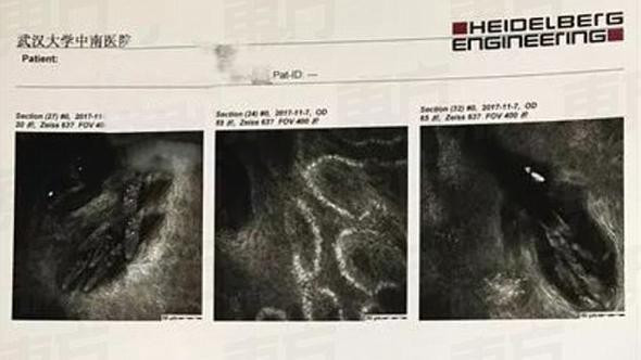 Gözünden ne çıktığını duyunca hayret edeceksiniz - Resim: 2