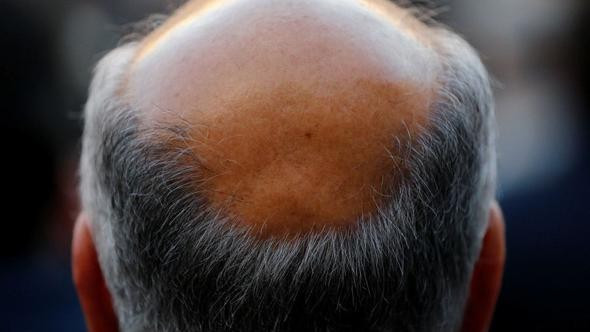 Ülkedeki kelleri tek tek öldürmeye başladılar! Polis alarm verdi - Resim: 1