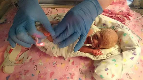 500 gramda doğdu 1 saat yaşamaz denildi son haline bakın - Resim: 1