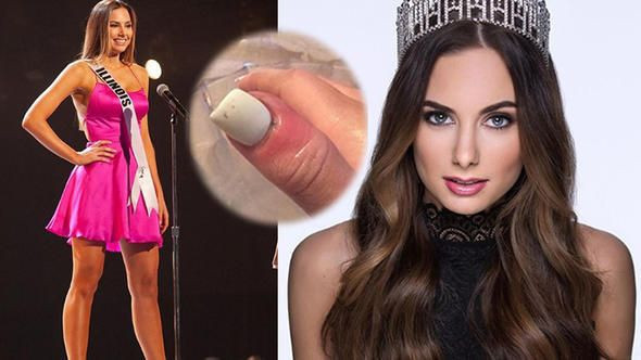 Şans eseri öğrenmişti Ünlü model kanseri böyle atlattı - Resim: 1