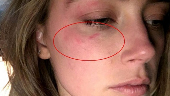 Ünlü oyuncudan inanılmaz olay! Eşinin yüzünü dağıttı - Resim: 2