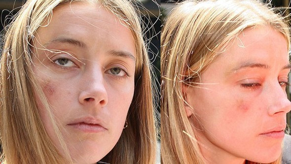 Ünlü oyuncudan inanılmaz olay! Eşinin yüzünü dağıttı - Resim: 3