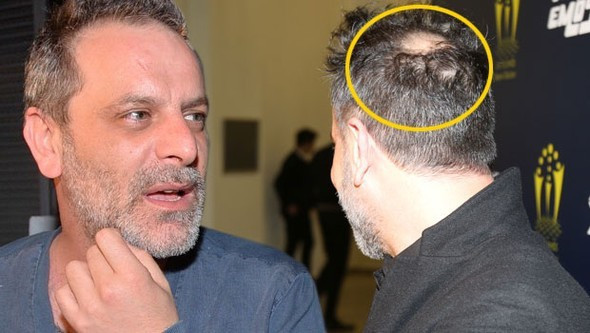 Ozan Güven'in görüntüsü şaşırttı - Resim: 2