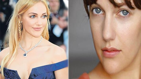 Meryem Uzerli'nin estetik yaptırdığı ortaya çıktı! - Resim: 1