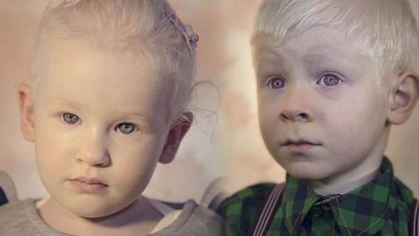 Onlar Türkiye'nin beyaz melekleri gören bir acayip bakıyor - Resim: 1