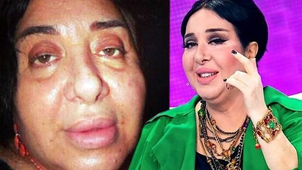 Ünlülerin bu hallerini görmediniz! - Resim: 4