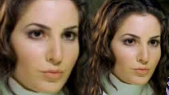 Müge Boz öyle bir estetik yaptırmış ki görenler şaştı kaldı - Resim: 1