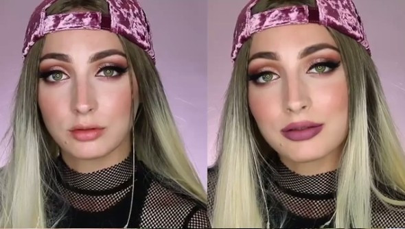 Yok artık! Vakumla dudak büyütüyorlar! - Resim: 4