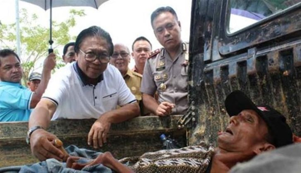 Hayatı bir gecede karardı! Vücudu taşlaşıyor resmen  - Resim: 1