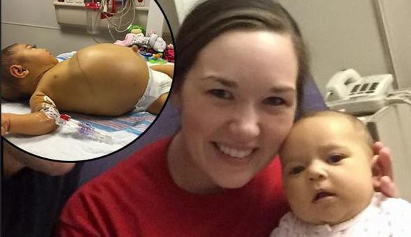 Bebeğin karnı her geçen gün şişiyordu öğrendikleri gerçekle şok oldular - Resim: 1