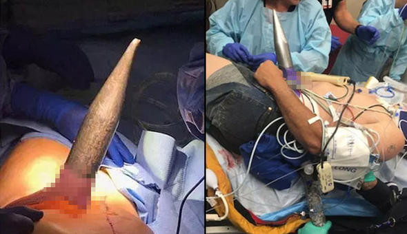 Bu halde getirildi doktorlar bile donup kaldı bakın sonra ne oldu - Resim: 2