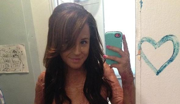 Çocukken yaşadığı olayı hatırladı kendini yaktı! - Resim: 4