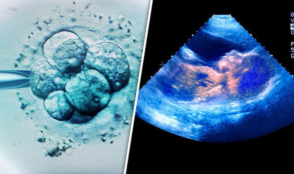 Tüp bebek aşamaları blastosist transferi nedir düşük ihtimali yüksek mi? - Resim: 1