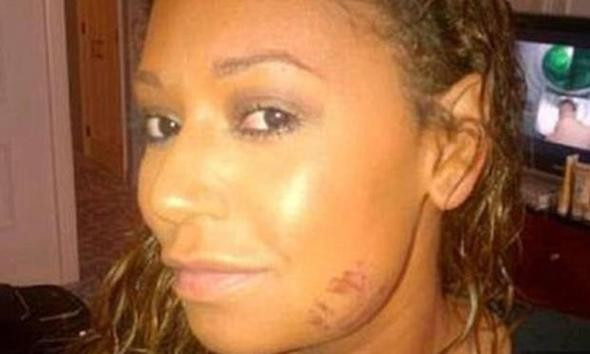 Ünlü şarkıcının boşanma nedenine bakın eşi dadıyı hamile bıraktı - Resim: 2