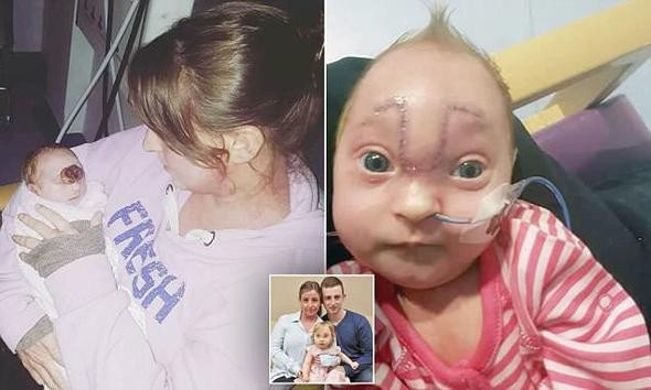 Tüm dünya onu konuştu beyni dışarıda doğdu! - Resim: 2