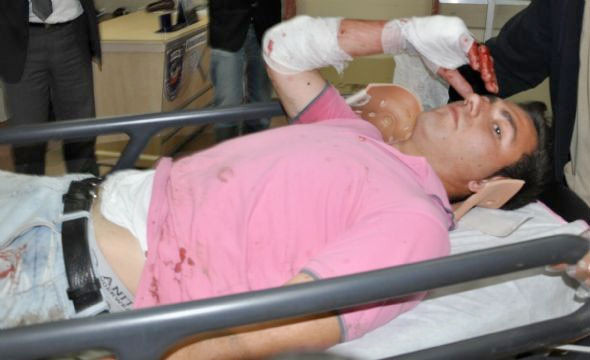 Bu araçtan sağ çıktılar - Resim: 1